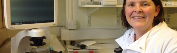 Reducing vein graft failure following heart bypass surgery