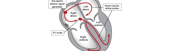 Arrhythmias