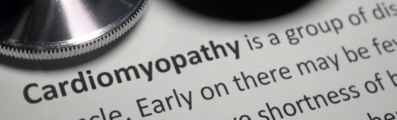 Cardiomyopathy