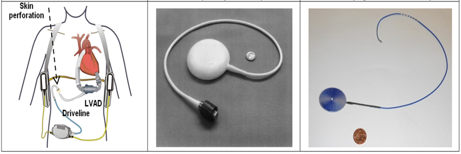LVAD_power_system_1