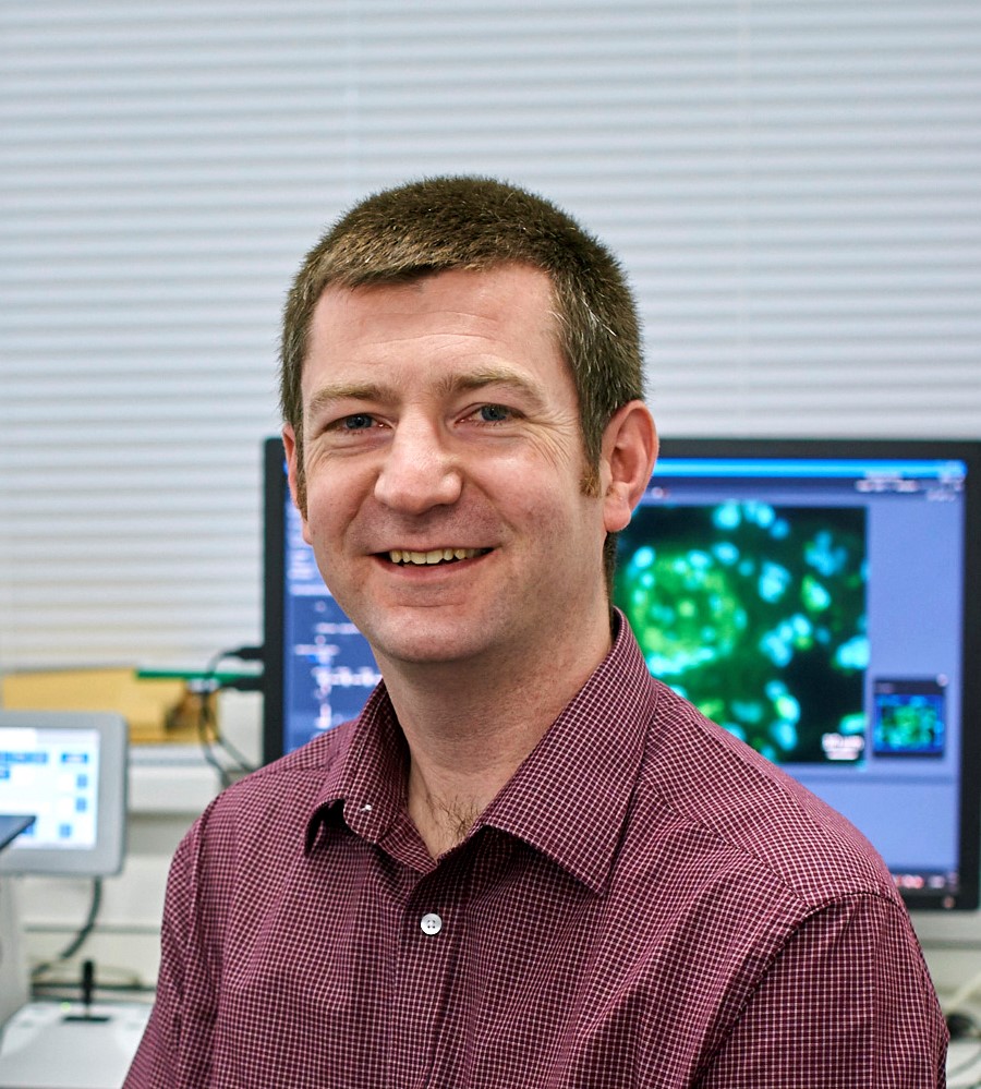 Improving detection of high blood pressure in the lungs using advanced imaging tools
