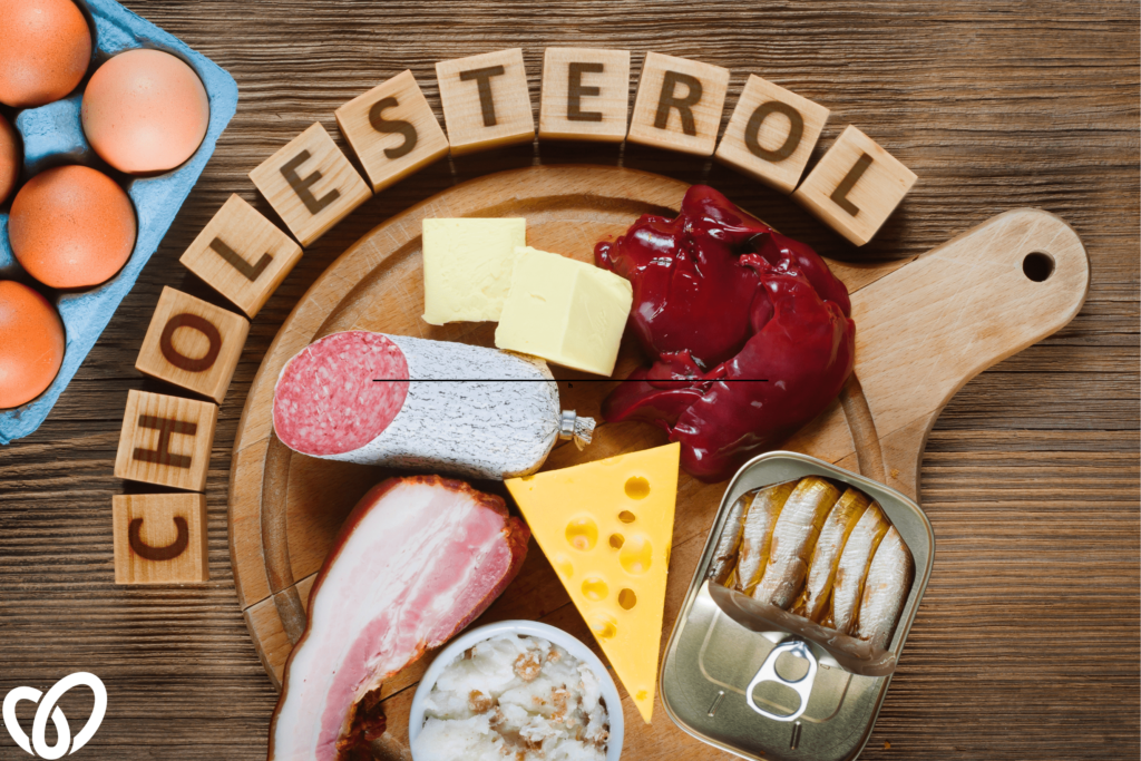 Charcuterie board with different meats and cheeses. The word 'cholesterol' is spelt out around the top of the board
